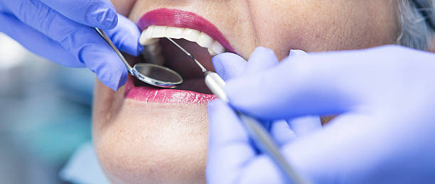 Best Emergency Tooth Extraction in Wintersville, OH